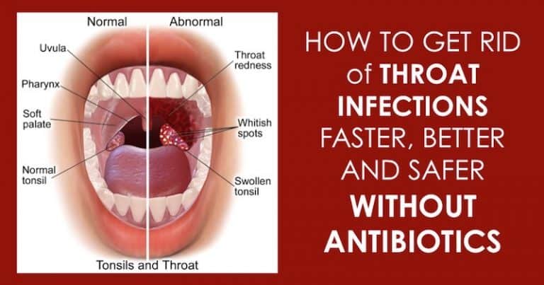8 Natural  Home Remedies to Reduce Swelling of Throat and Treat A Strep Throat Infection