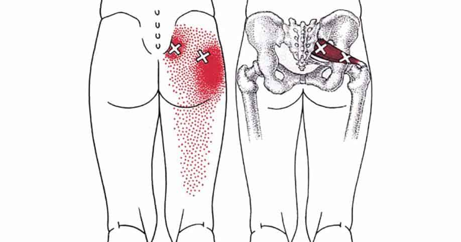 How To Get A Deep Piriformis Stretch To Get Rid Of Pain In The Back, Hip, Buttocks & Legs