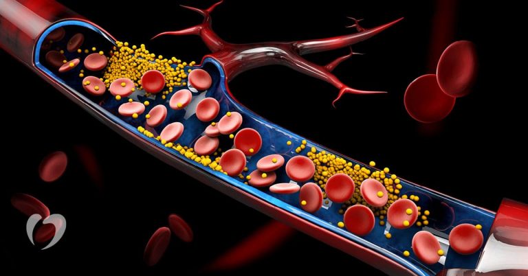 a graphical image depicting cholesterol
